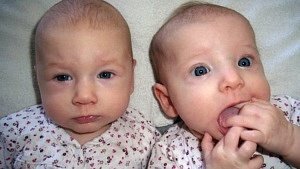 twin birth stories