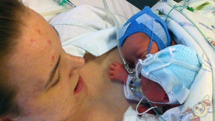 twin pregnancy stories