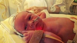 twin pregnancy and premature baby stories