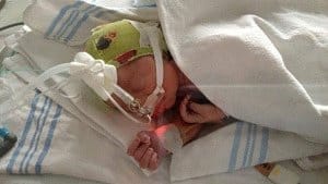 twin pregnancy and premature baby stories