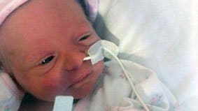 twin birth and pregnancy stories