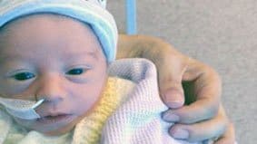 twin birth and pregnancy stories