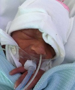 twins born at 28 weeks